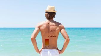 melanoma